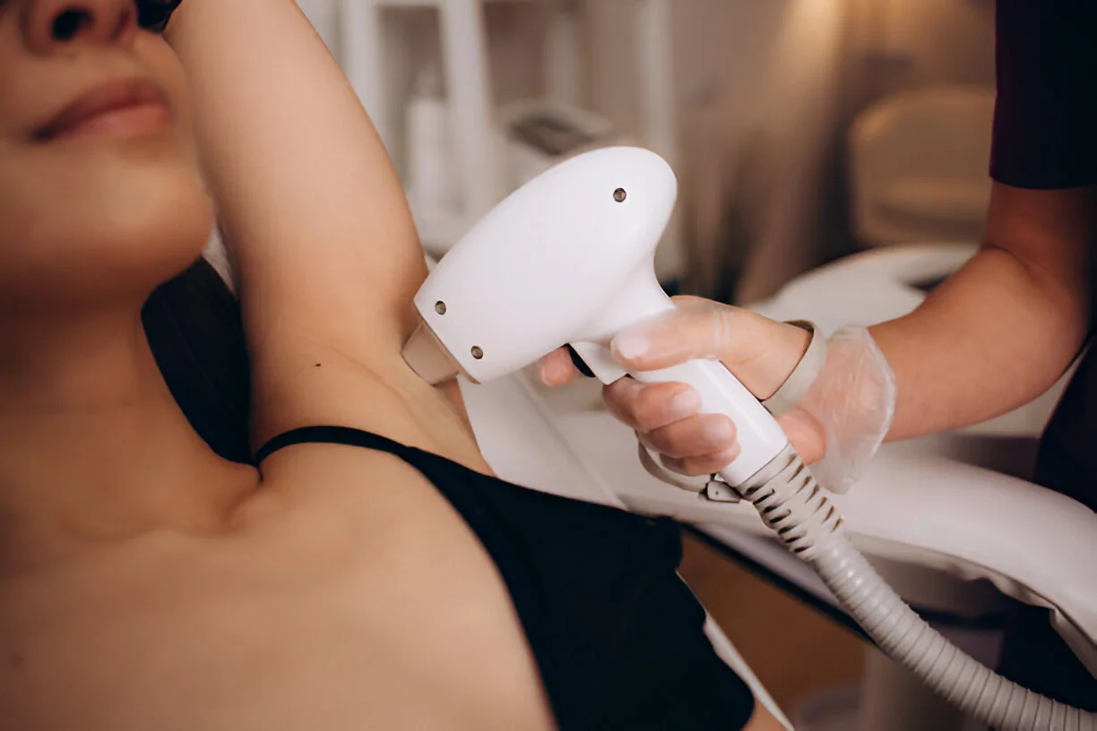 trusted laser hair removal service in mississauga