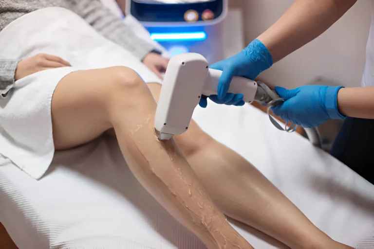 Laser Hair Removal: How Many Sessions Are Needed?