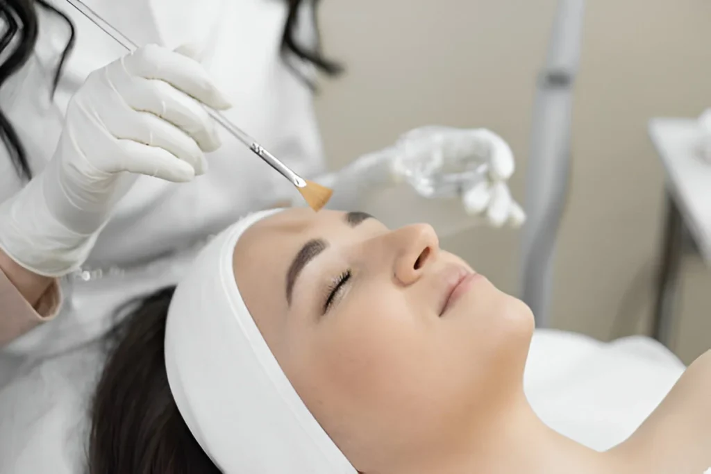 Medical grade chemical peels in Richmond Hill for skin rejuvenation