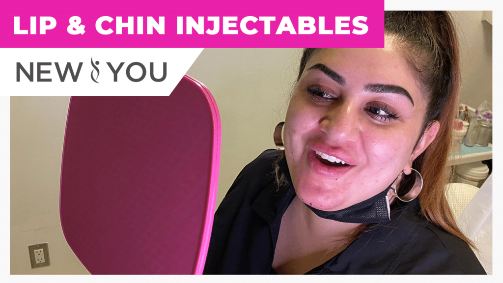 Lip And Chin Injectables